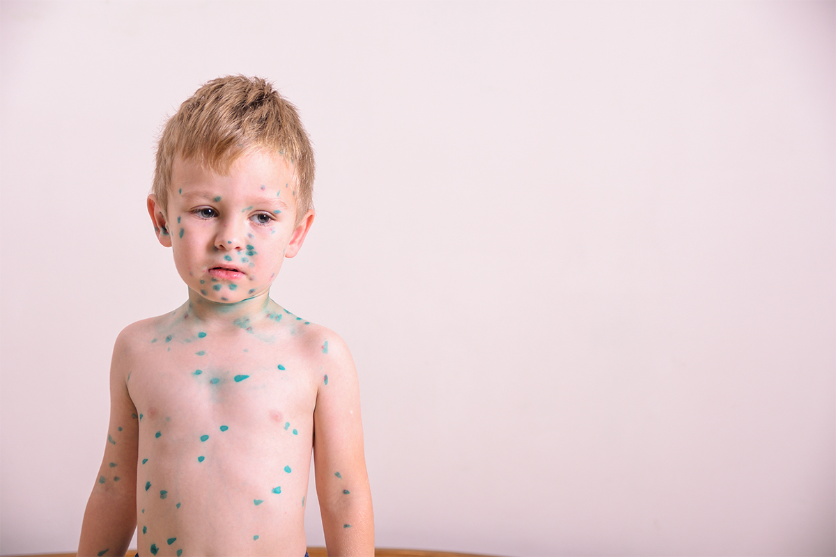 Consejos clave para el cuidado de la piel infantil segun expertos - La Relevancia del Cuidado Dermatol&oacute;gico Infantil