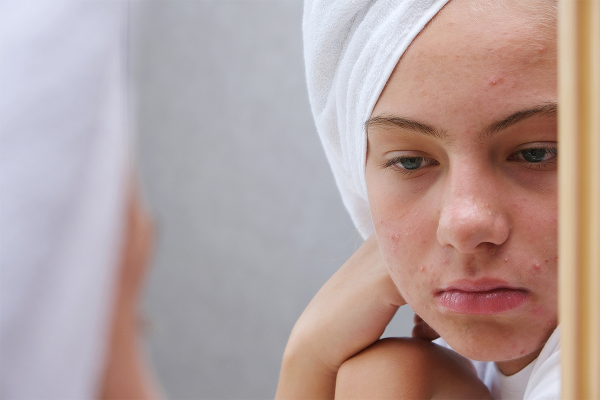 Enfermedades Cutaneas Comunes en Ninos - Dermatolog&iacute;a Infantil: C&oacute;mo Cuidar la Piel de los M&aacute;s Peque&ntilde;os